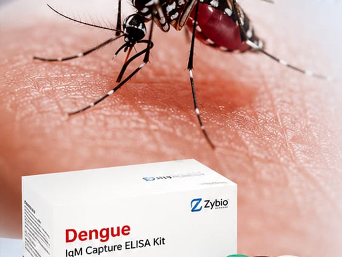 Dengue IgM Capture ELISA Kit